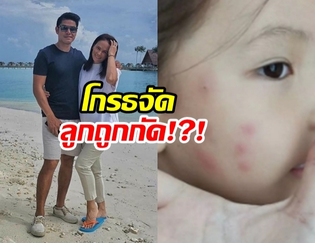 ภูริ สั่งตบ!?! แอน-อลิชา โกรธจัดหลังลูกสาวถูกกัดหน้าช้ำ! 