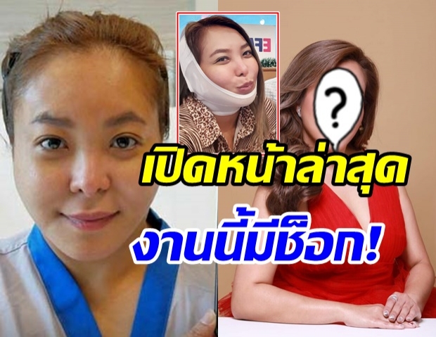 เข้าที่แล้ว! เปิดหน้าล่าสุด ดีเจดาด้า หลังตัดสินใจทำศัลยกรรม ในวัย 40 ปี