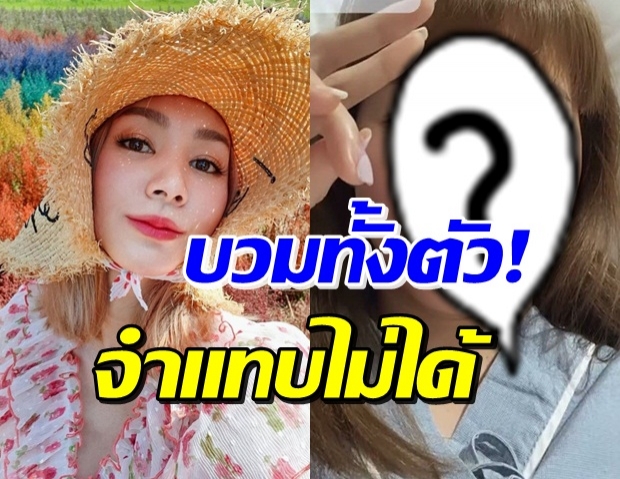 ส่งกำลังใจ โฟร์ เปิดหน้าล่าสุด ตกใจหนักมาก! เคราะห์ซ้ำนอนรพ.ต่อ 