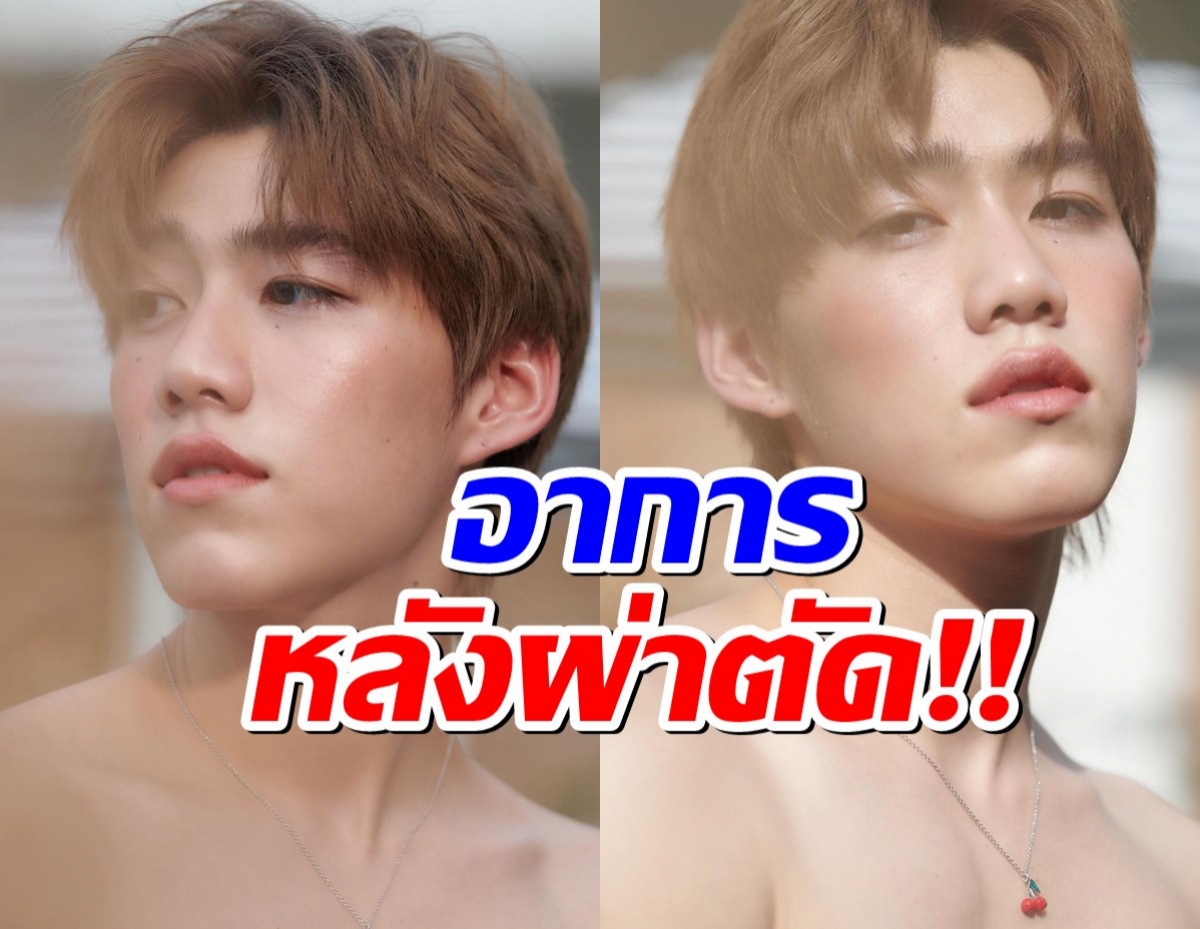 นาดาวแถลงอาการ พีพี กฤษณ์ หลังผ่าตัดนิ่วในต่อมทอนซิล