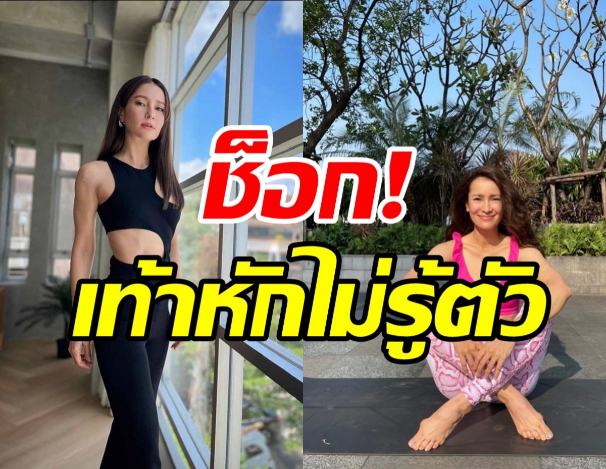 แอน ทองประสม เผยอุทาหรณ์เท้าหักไม่รู้ตัว พฤติกรรมแบบนี้อย่าทำ