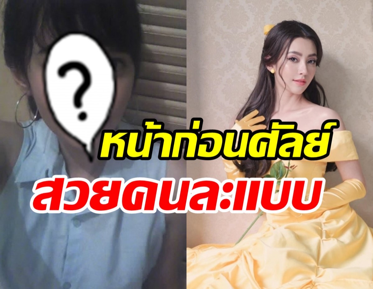 โซเชียลแชร์ภาพหน้าเก่า-ใหม่ เบลล่าศัลย์แล้วปังเป๊ะไร้ที่ติ