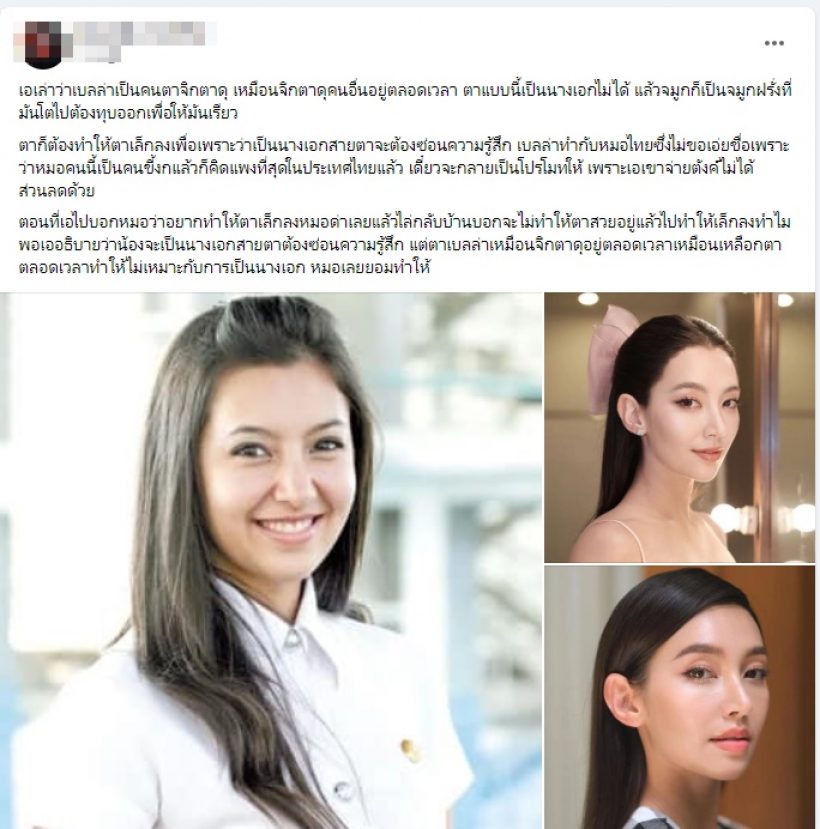 โซเชียลแชร์ภาพหน้าเก่า-ใหม่ เบลล่าศัลย์แล้วปังเป๊ะไร้ที่ติ