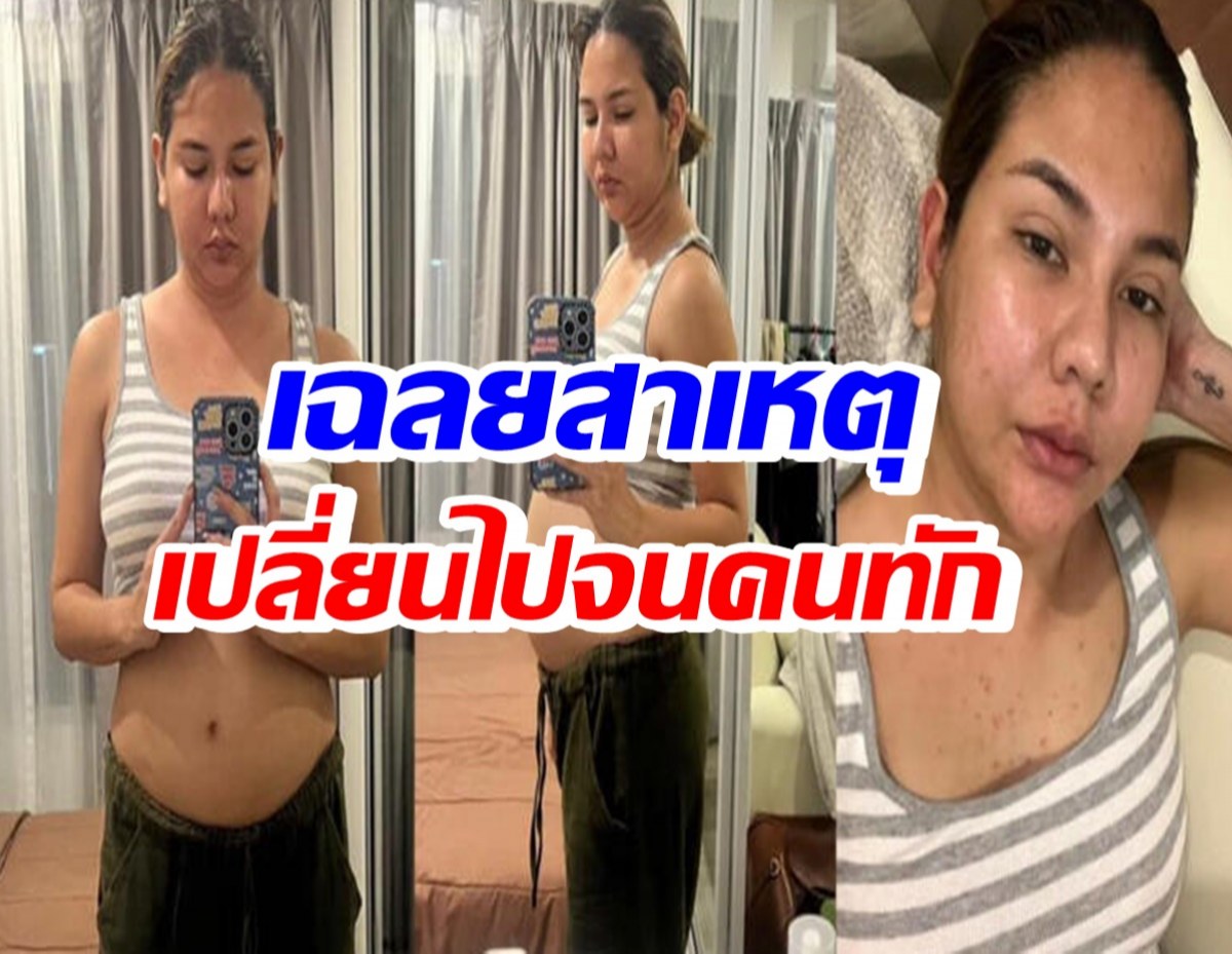 โพสต์พลีชีพ! หมิว สิริลภัส เผยหุ่นล่าสุด พร้อมเปิดสาเหตุที่คนทัก