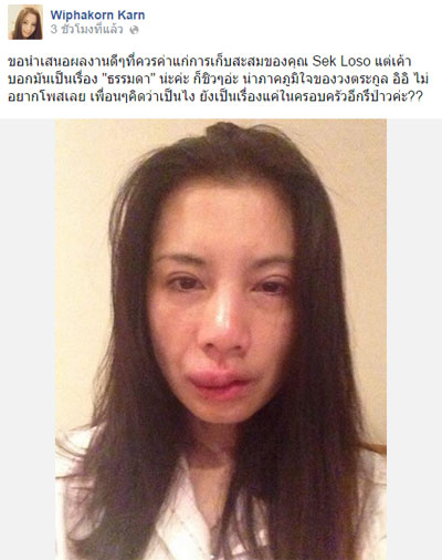 กานต์โพสต์ภาพแฉเสก โลโซ โวยถูกซ้อมไม่หนำใจสาดน้ำใส่