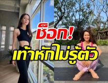 แอน ทองประสม เผยอุทาหรณ์เท้าหักไม่รู้ตัว พฤติกรรมแบบนี้อย่าทำ