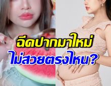 โดนติอีกแล้ว!! ดาราสาวดัง ตอกกลับคนทัก ฉีดปากแล้วไม่สวย