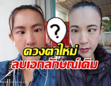 ภาพล่าสุดตลกดัง ตาหวาน ได้ดวงตาใหม่ แทบจำหน้าเดิมไม่ได้