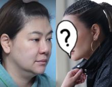 โอ๋ ภัคจีรา อัปเกรดหน้าใหม่ แก้จมูกรอบ 30 ปี สวยละมุนจนจำไม่ได้