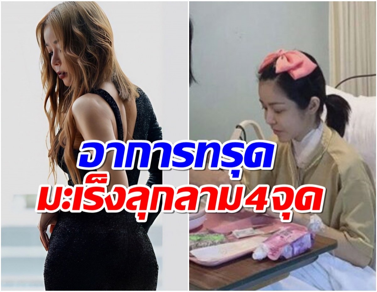 ส่งกำลังใจให้ นักเเสดงสาวคนดัง มะเร็งลุกลามเตรียมบินรักษาที่จีน