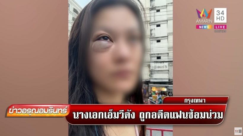 นางเอก MVเพลงชื่อดัง ถูกอดีตแฟนซ้อมน่วม ก่อนหนีจากโรงพัก