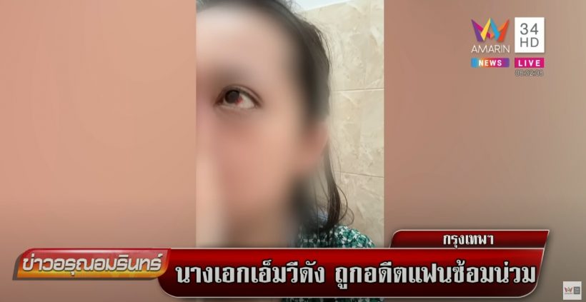นางเอก MVเพลงชื่อดัง ถูกอดีตแฟนซ้อมน่วม ก่อนหนีจากโรงพัก