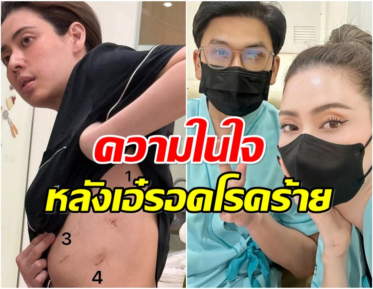 น้ำตาซึม! ป๋อ ณัฐวุฒิ โพสต์ซึ้งถึง เอ๋ หลังผ่าน 1 เดือนมรสุมชีวิต