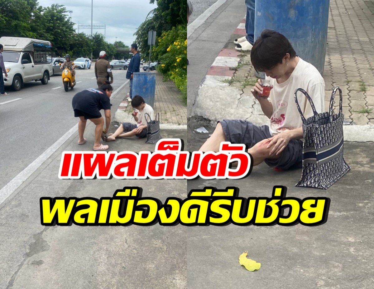 ตกใจทั้งถนน! ดาราดังประสบอุบัติเหตุ นั่งเจ็บเลือดเต็มตัว