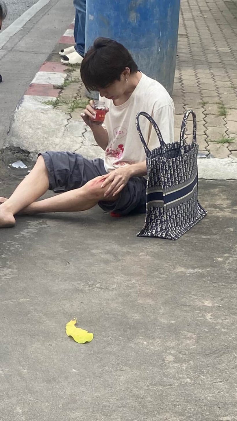 ตกใจทั้งถนน! ดาราดังประสบอุบัติเหตุ นั่งเจ็บเลือดเต็มตัว