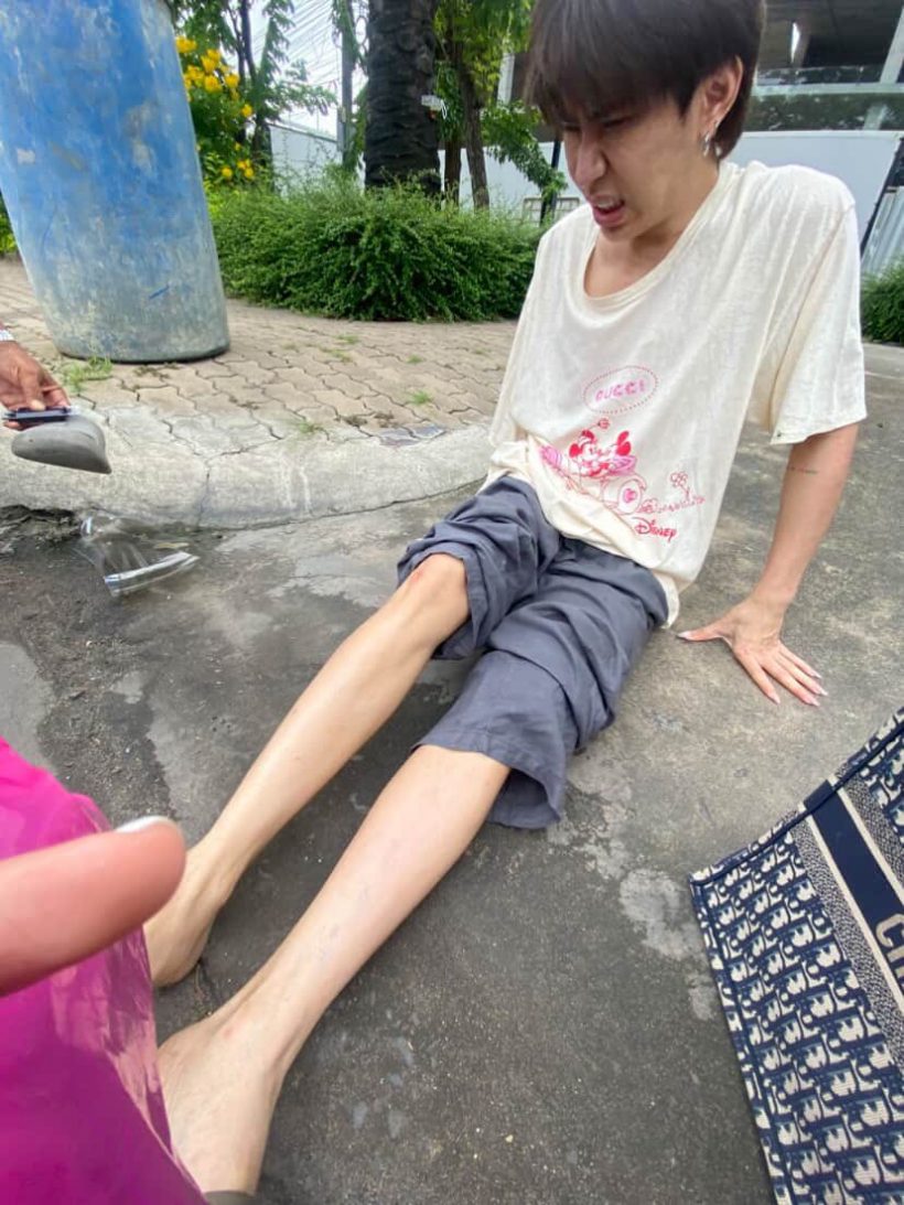 ตกใจทั้งถนน! ดาราดังประสบอุบัติเหตุ นั่งเจ็บเลือดเต็มตัว