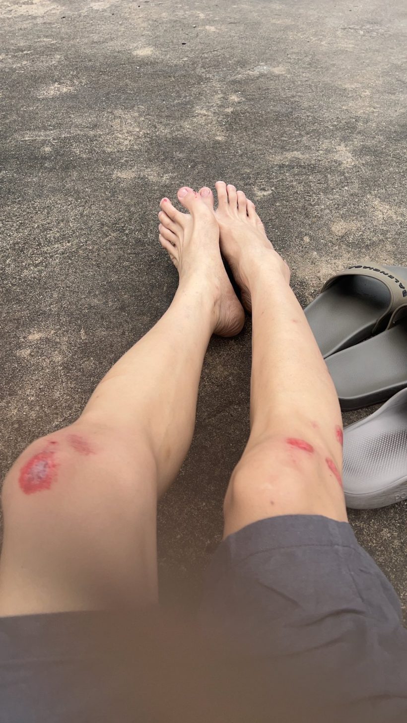 ตกใจทั้งถนน! ดาราดังประสบอุบัติเหตุ นั่งเจ็บเลือดเต็มตัว