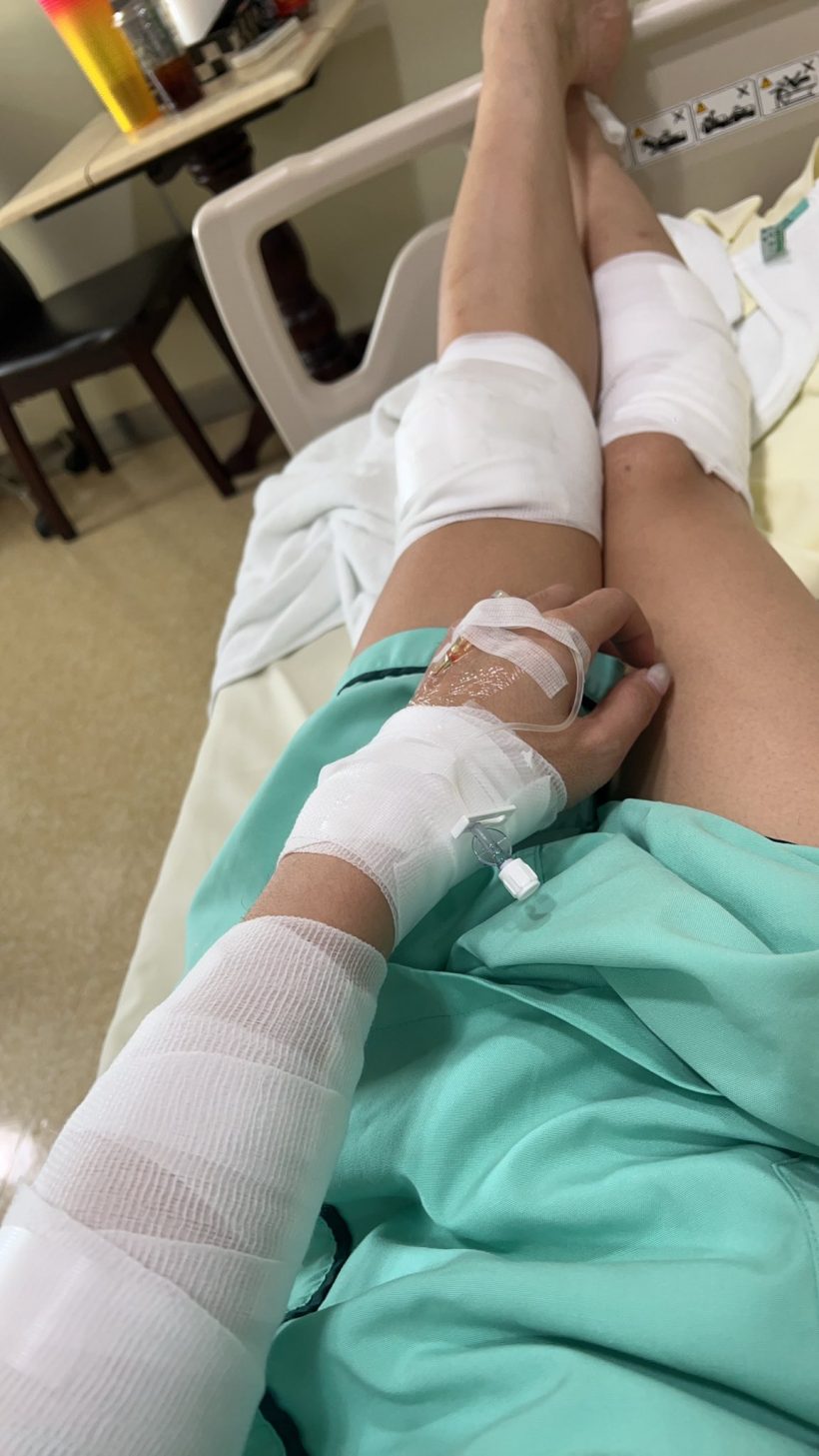 ตกใจทั้งถนน! ดาราดังประสบอุบัติเหตุ นั่งเจ็บเลือดเต็มตัว