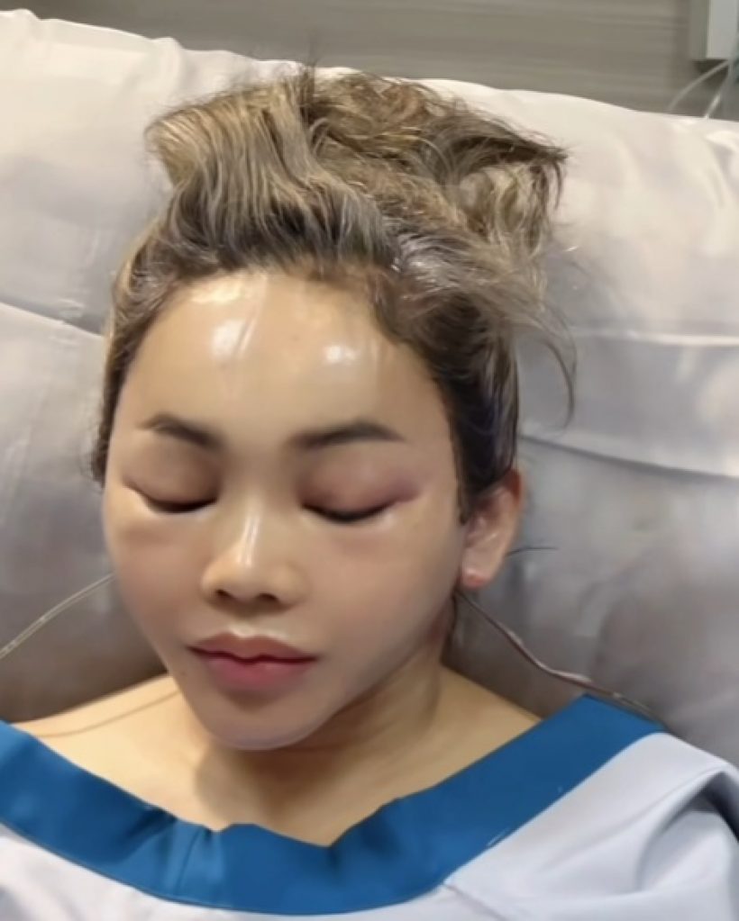 จำแทบไม่ได้! ตั๊กแตน ชลดา ทำหน้าใหม่ สวยกระชากวัยสุด
