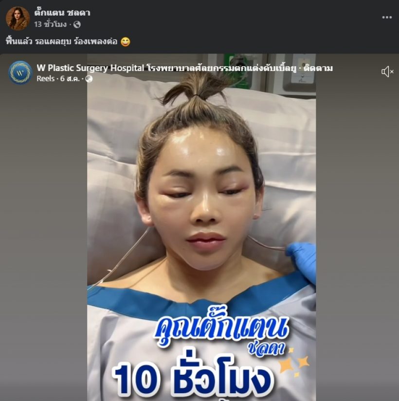จำแทบไม่ได้! ตั๊กแตน ชลดา ทำหน้าใหม่ สวยกระชากวัยสุด