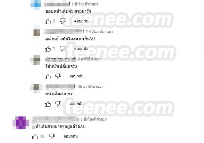 ชาวเน็ตติงยับ!! ใบหม่อนหน้าเปลี่ยนไปมาก จมูกเก่าสวยกว่า