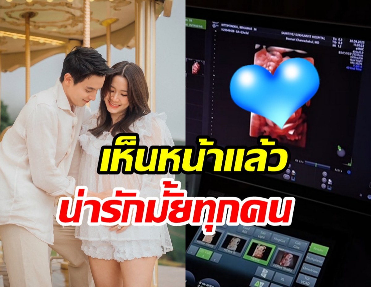 เปิดหน้าทายาท เจมส์ จิรายุ-โฟม คุณพ่อถาม น่ารักไหม?