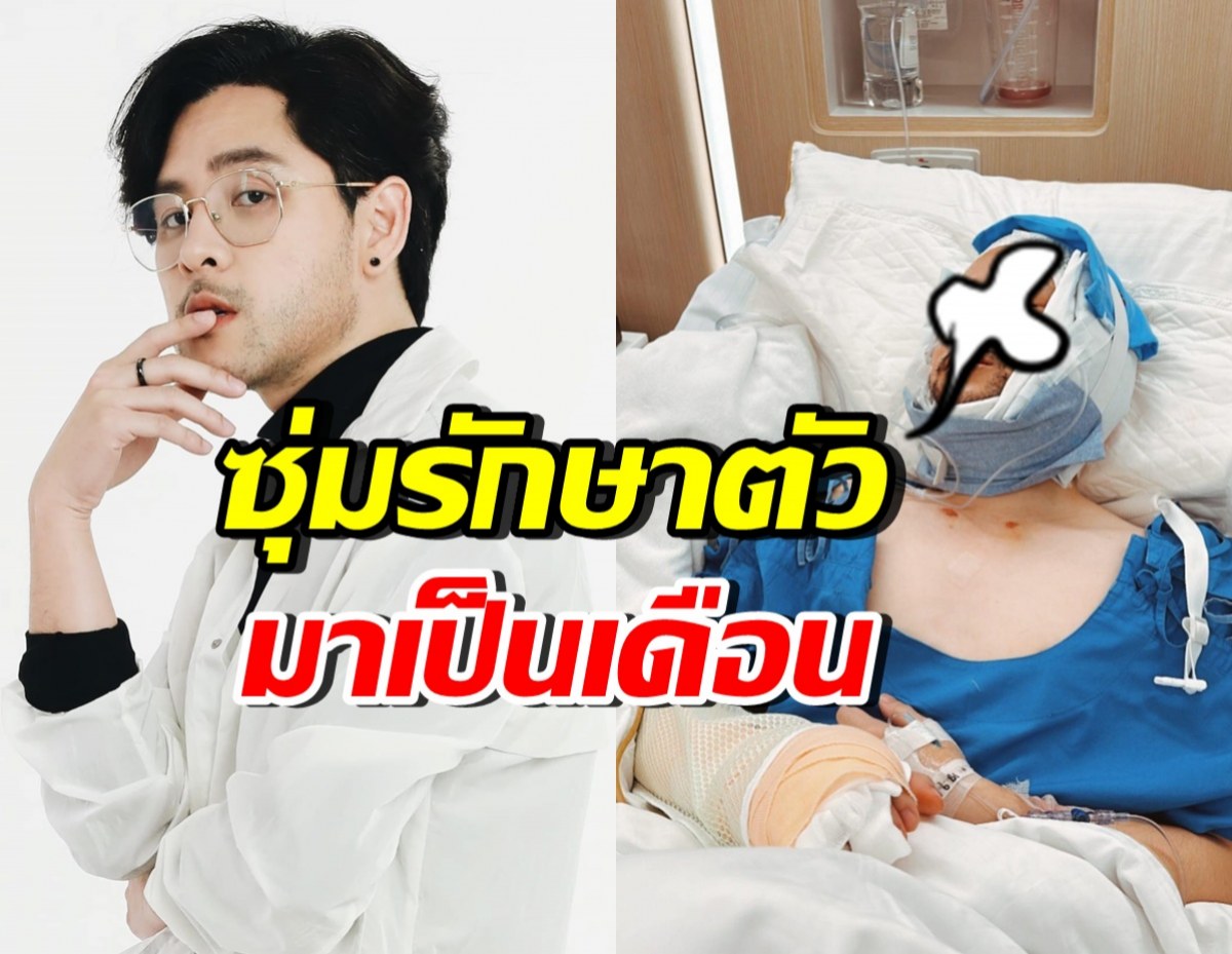 ทอม อิศรา ประสบอุบัติเหตุรุนแรง เผยอาการเป็นหนักกว่าที่คิด
