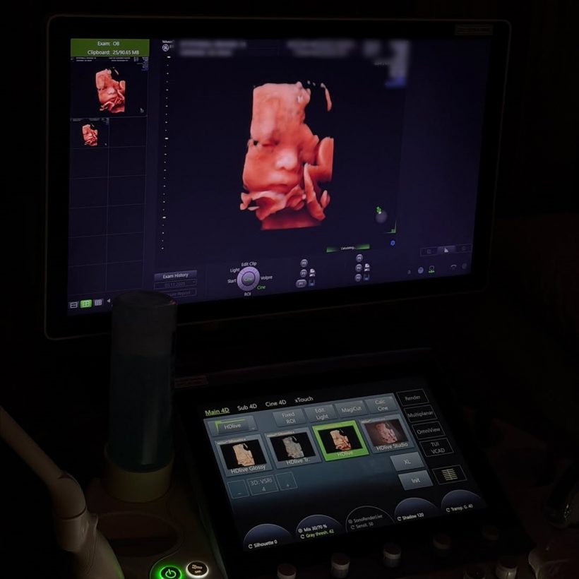 หล่อตะโกน! เจมส์จิ อวดภาพลูกชายชัดๆดั้งพุ่งทะลุจอ