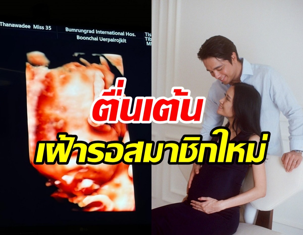 ตื่นเต้นทั้งบ้าน อเล็กซ์ เรนเดลล์ นับวันรอภรรยาให้กำเนิดลูกชายแล้ว