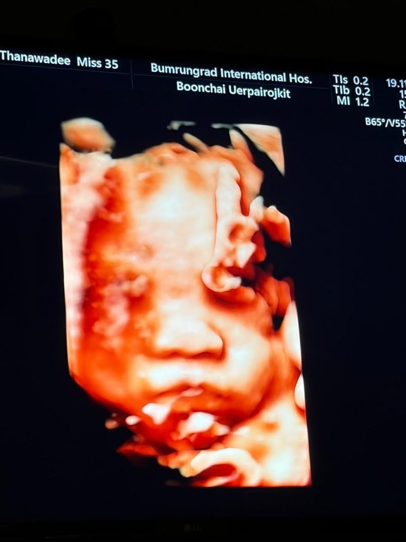 ตื่นเต้นทั้งบ้าน อเล็กซ์ เรนเดลล์ นับวันรอภรรยาให้กำเนิดลูกชายแล้ว