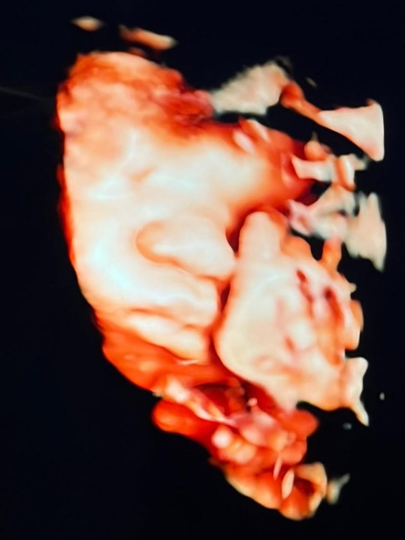 ตื่นเต้นทั้งบ้าน อเล็กซ์ เรนเดลล์ นับวันรอภรรยาให้กำเนิดลูกชายแล้ว