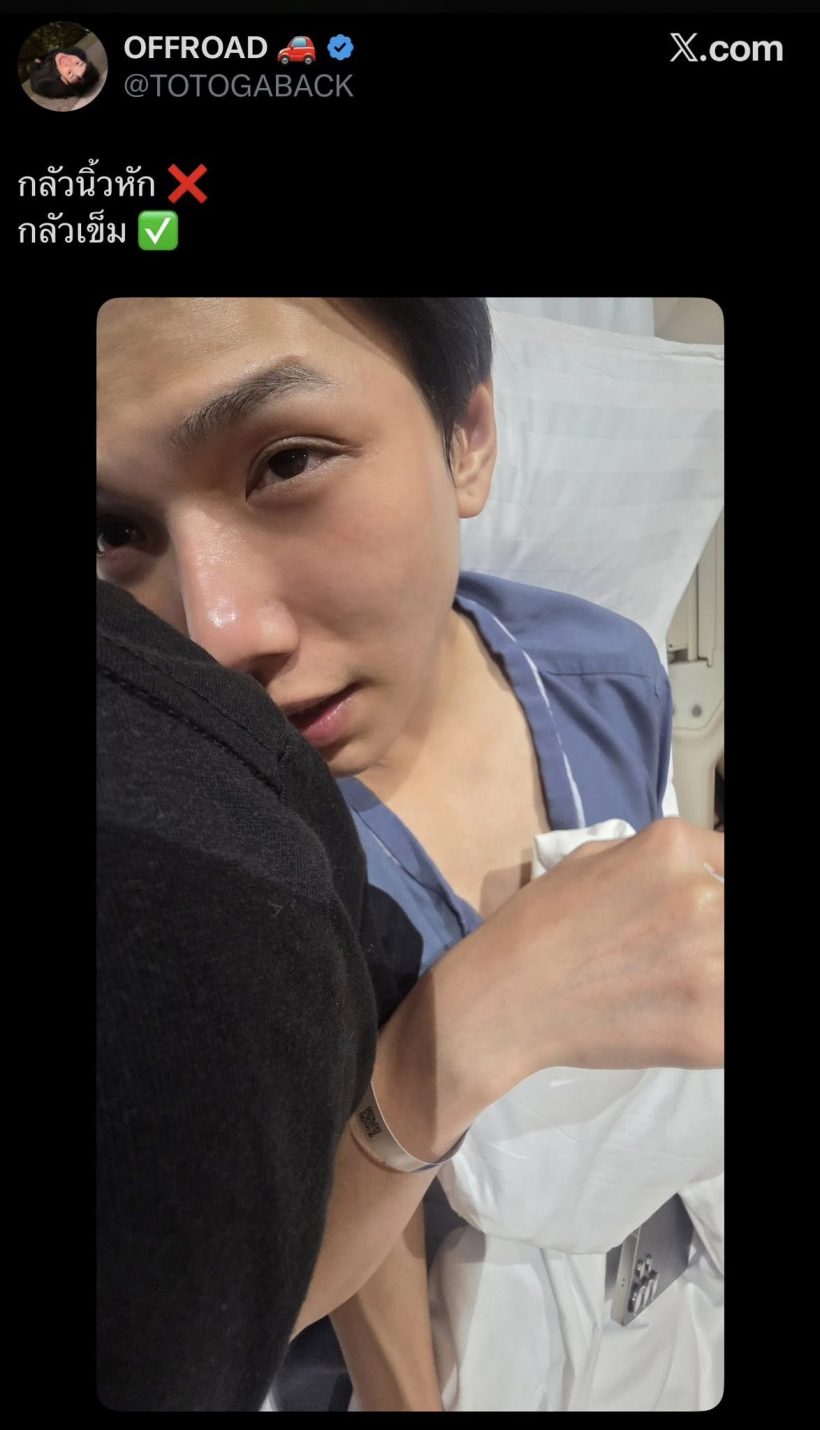 แฟนๆ เป็นห่วง หนุ่มฮ็อตประสบอุบัติเหตุนิ้วหัก