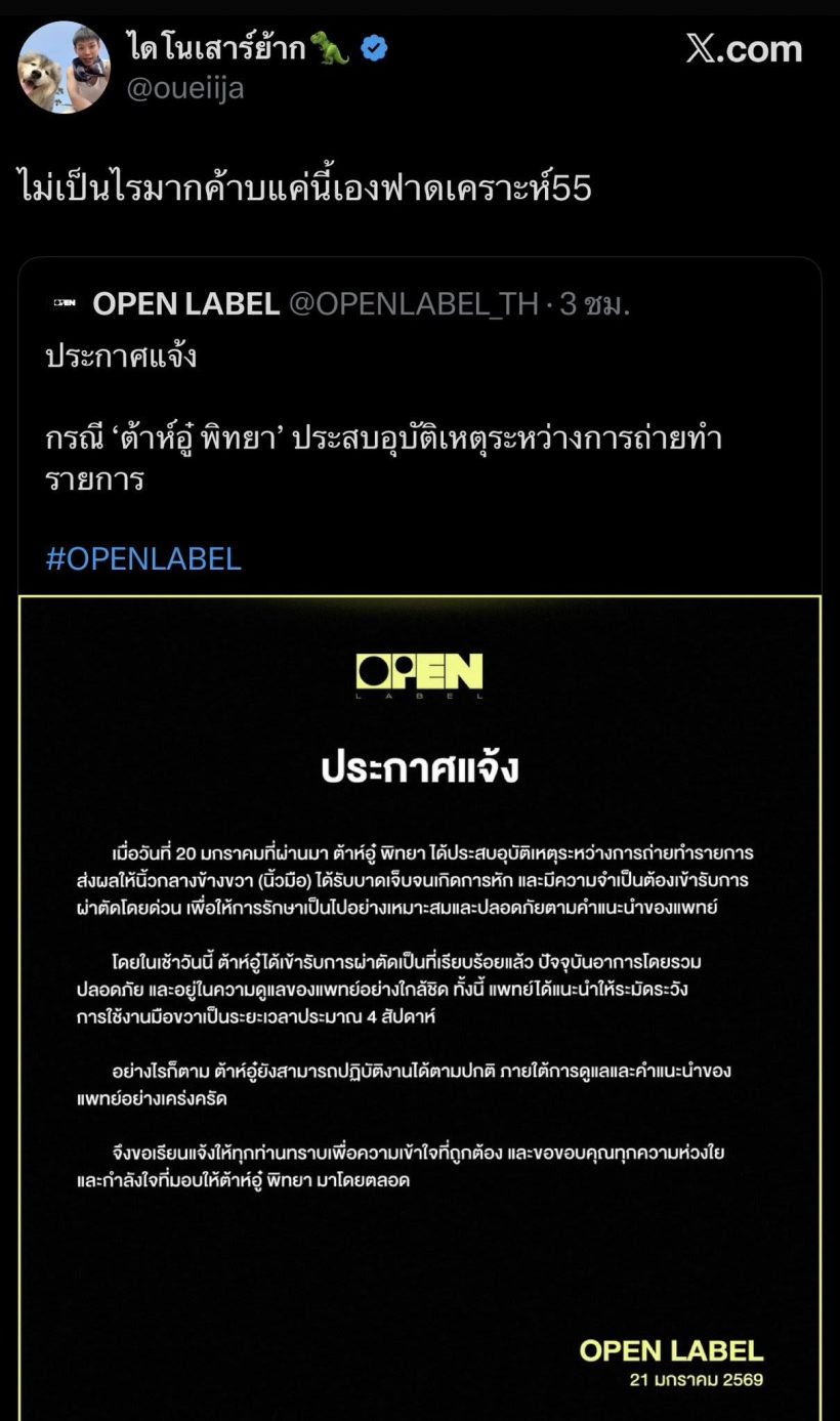 แฟนๆ เป็นห่วง หนุ่มฮ็อตประสบอุบัติเหตุนิ้วหัก