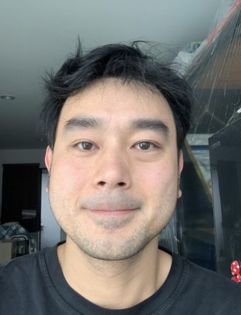 ดาราหนุ่มดัง มีภาวะสมองผิดปกติ หวั่นจำหน้าลูกเมียไม่ได้