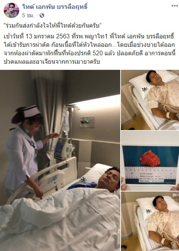  “ไทด์ เอกพันธ์” อัปเดตอาการ ผ่าตัดก้อนเนื้อใต้หัวไหล่ พร้อมขอบคุณทุกกำลังใจ