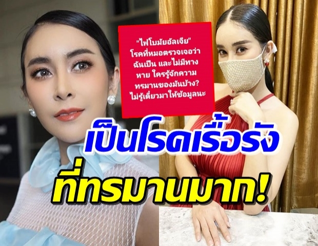 ‘ใหม่ สุคนธวา’ ป่วยโรคไฟโบมัยอัลเจีย รุนแรงถึงขั้นเกือบคิดสั้น