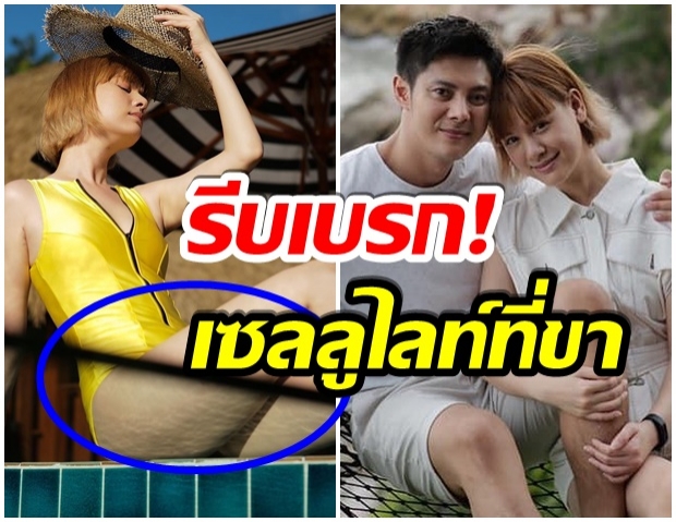 รีบเเจงด่วน! เกล โพสต์ภาพนี้ เบรกตัวเองเพราะกลัวคนทัก มีเซลลูไลท์ 