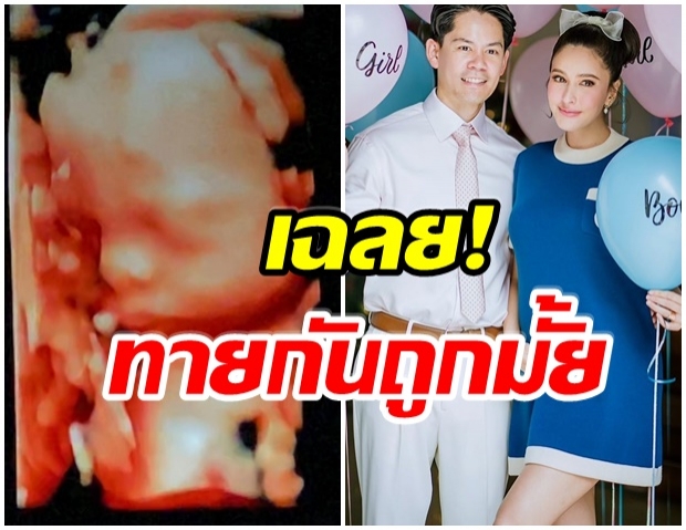 ริต้า-กรณ์ เฉลยเพศลูกคนเเรกเเล้ว ผช-ผญ ทายถูกมั้ย 