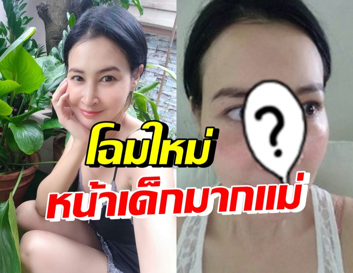 เปิดหน้าล่าสุด ษา วรรณษา งัดดั้งใหม่ หลังเคยฉีดซิลิโคนเถื่อน