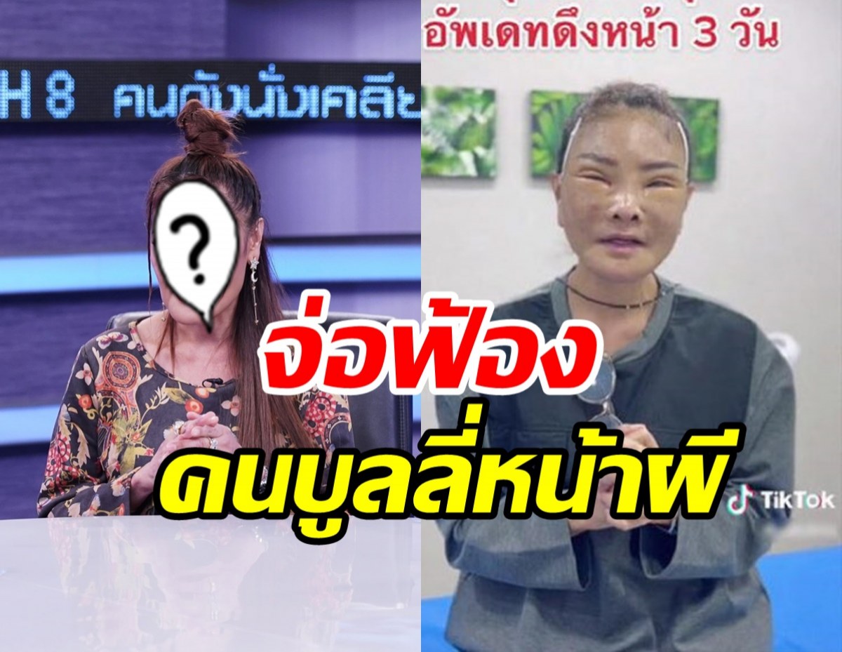  นักร้องสาวจ่อฟ้องคนบลูลี่หน้า เปิดสาเหตุศัลยกรรมสุดท้ายในชีวิต