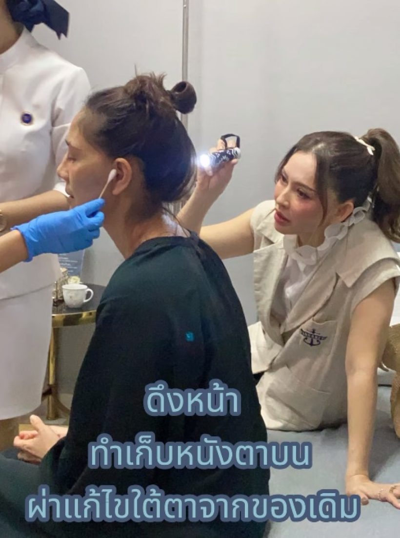  ดูกันให้ชัดหน้าใหม่ นก สินจัย ย่องศัลยกรรมสวยกระชากวัยใกล้เลข6