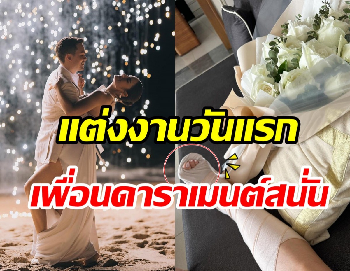 สุดพีค! เจ้าสาวป้ายแดงรีวิวแต่งงานวันแรก เจ็บหนักต้องดามเฝือก