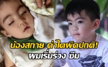 “น้องสกาย” ผมเริ่มร่วง ซึม ค่าไตผิดปกติ หลังให้คีโมรอบแรก ต้องเฝ้าระวัง!!!