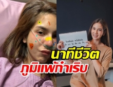 หมิว สิริลภัส เกือบเอาชีวิตไม่รอด! นาทีภูมิแพ้กำเริบ​ระหว่างออกกำลังกาย​