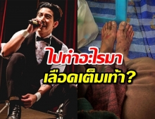 ไปทำอะไรมา โตโน่ โชว์แผล เลือดซิบเต็มเท้า 