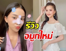 อาม ชุติมา ไม่หยุดสวย อัพจมูกใหม่-แพลนเพิ่มหน้าอก