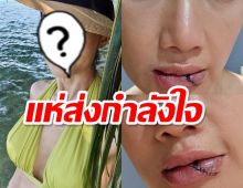 แห่ส่งกำลังใจดารารุ่นใหญ่เกิดอุบัติเหตุรถพัง-ปากฉีก