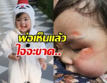 พ่อจะร้องไห้ นักร้องดัง สงสารลูกได้แผลแรกวัย1ขวบ4เดือน