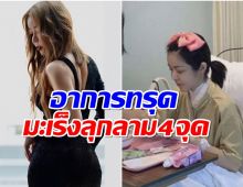 ส่งกำลังใจให้ นักเเสดงสาวคนดัง มะเร็งลุกลามเตรียมบินรักษาที่จีน