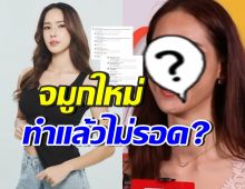 ชาวเน็ตติงยับ!! ใบหม่อนหน้าเปลี่ยนไปมาก จมูกเก่าสวยกว่า